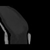 SPORK, NICO - 22.03.1976 - 02.08.2022 - CT obere Extremität - 18:01:46
